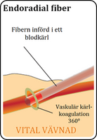 Endoradial fiber - Schematisk